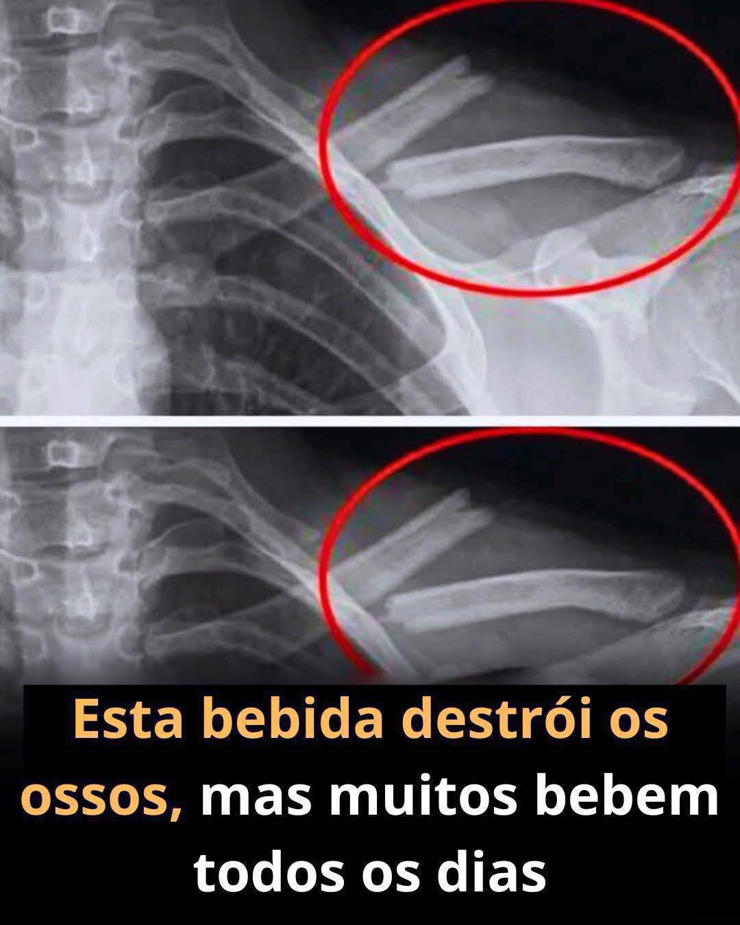 Este líquido destrói os ossos? Você sabe de qual bebida estou falando?