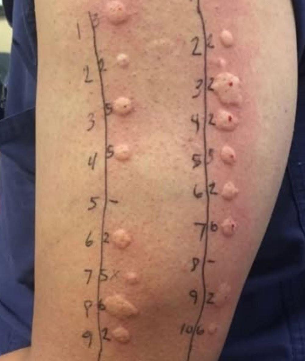 Viu isto na pele ao acordar? Veja o que pode ser e quando se preocupar