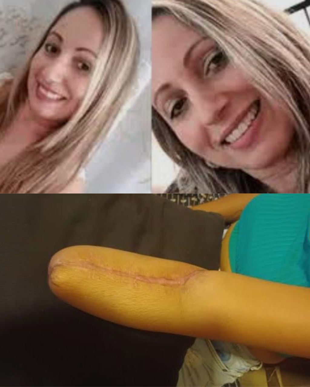 Professora sofre ferimentos durante ataque a uma escola em Suzano