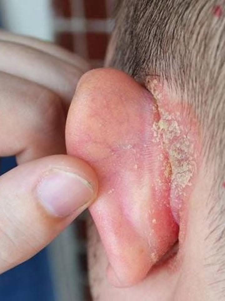 Meu filho amanheceu com uma mancha na orelha: o que isso pode ser e como cuidar até a consulta?
