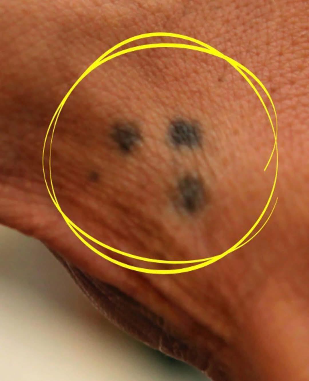 Se você ver alguém com uma tatuagem de três pontos na mão, é melhor ter cuidado…