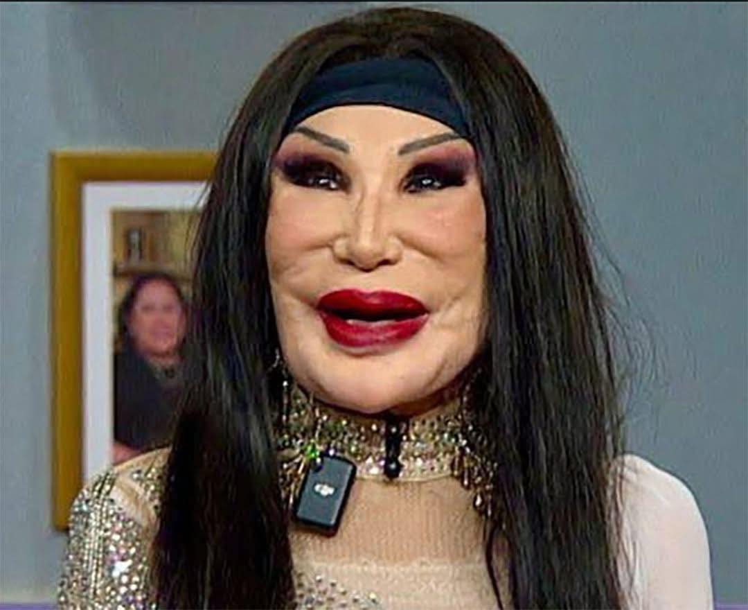 Ela era uma atriz famosa, tendo atuado em cerca de cem filmes, mas um erro trágico arruinou completamente a sua aparência